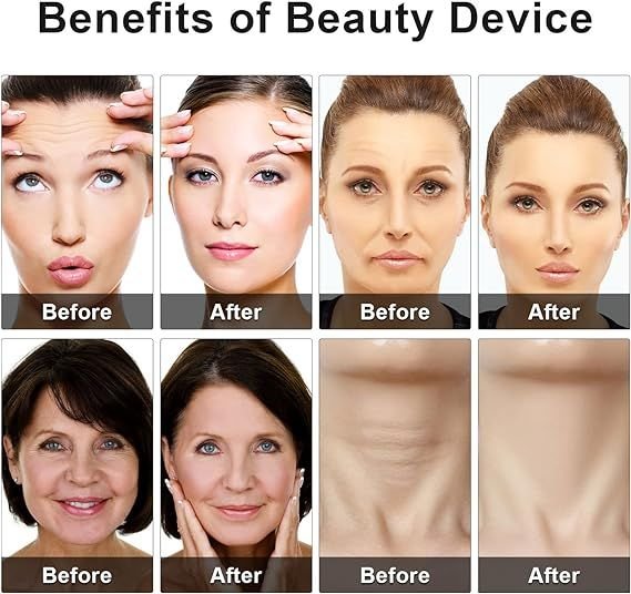 Eye Beauty Device - Image 4